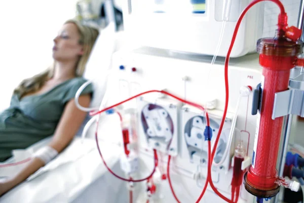 Hemodialysis